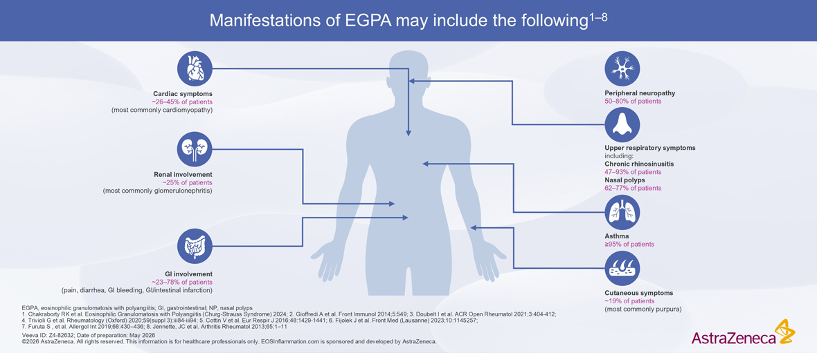 EGPA Clinical Manifestations Symptoms
