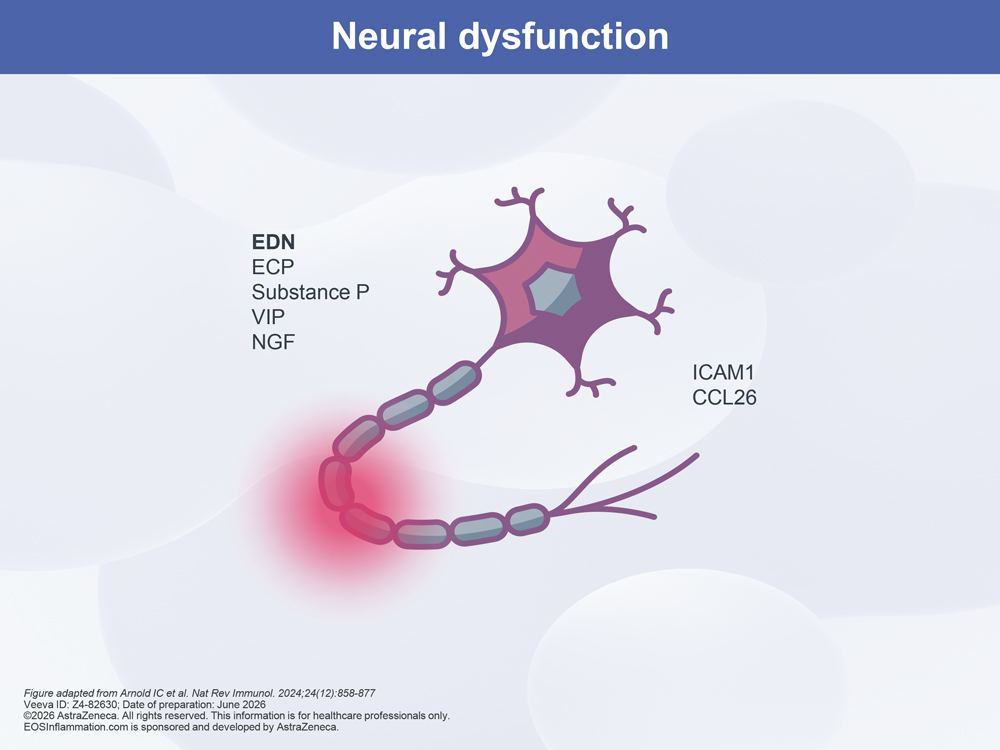 Neural Dysfunction Diagram
