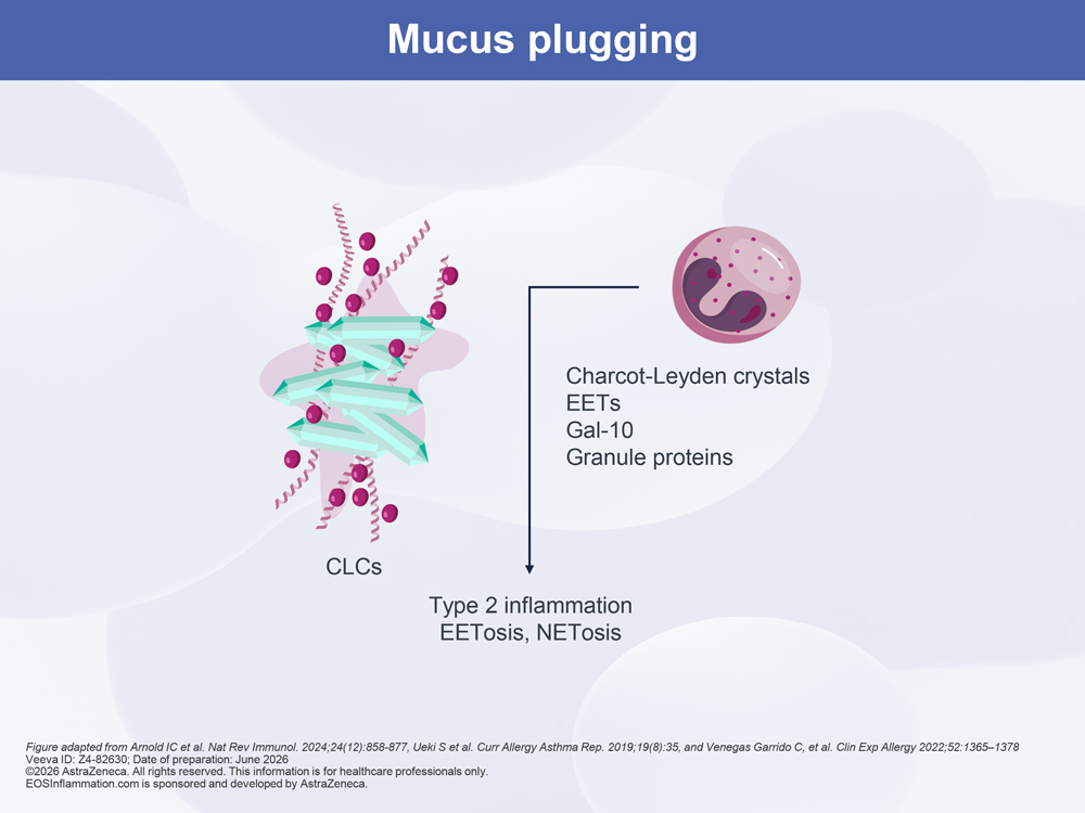 MUCUS PLUGGING DIAGRAM