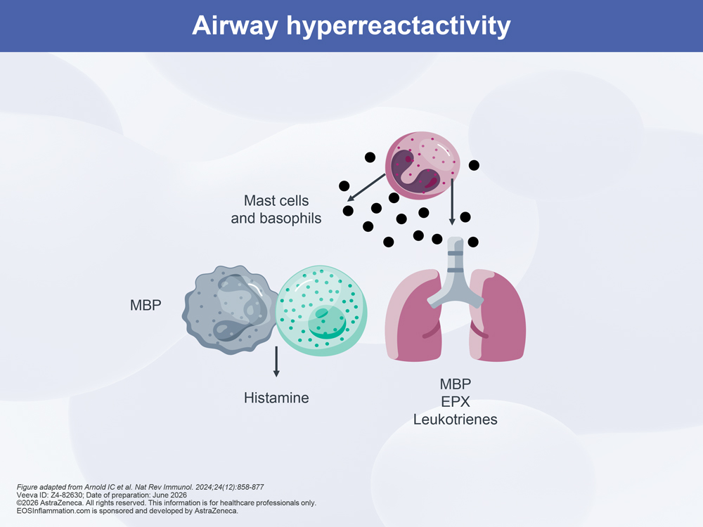Airway Hyperreactivity Diagram