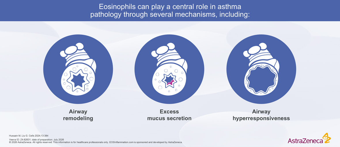 Role of Eosinophils in Asthma Pathology