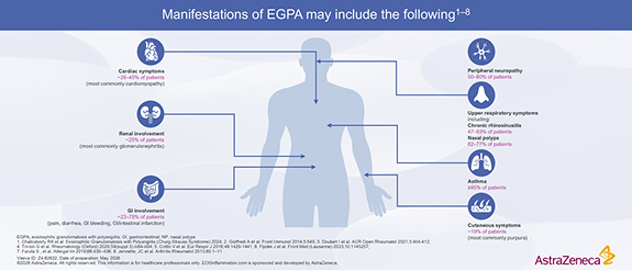EGPA Clinical Manifestations Symptoms