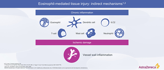 Eosinophil Mediated Tissue Injury Indirect Mechanisms