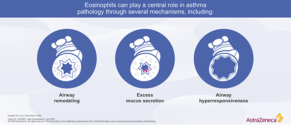 Role of Eosinophils in Asthma Pathology